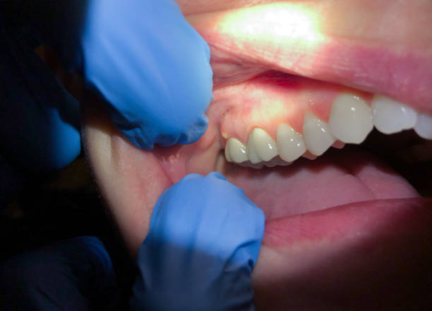 Best Emergency Denture Repair in Wake Village, TX