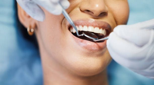 Best Emergency Cosmetic Dentistry (e.g., broken veneers) in Wake Village, TX